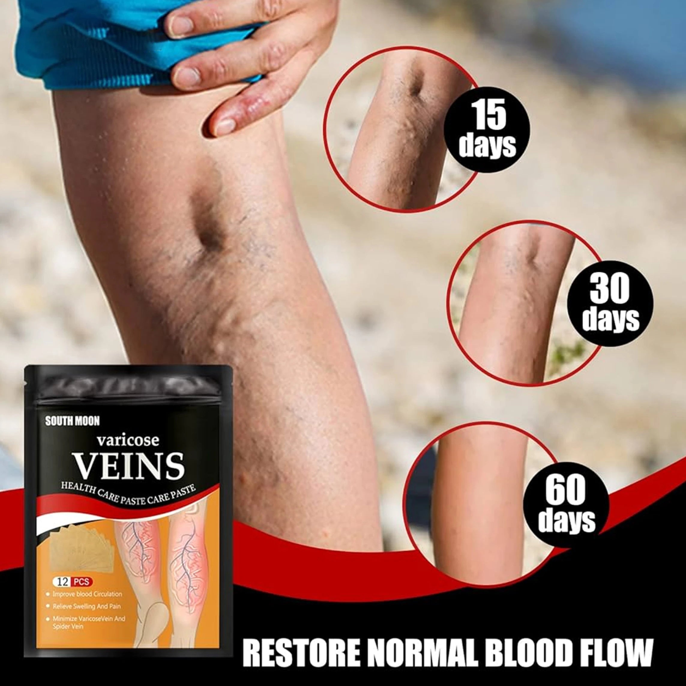 Navveda Turmeric Varicose Vein Patches | Natural Herbal Therapy for Swelling, Fatigue & Vein Health