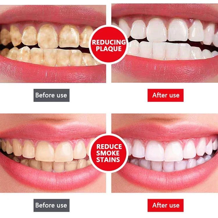 SP-4 probiotic Natural whitening toothpaste (BUY 1 GET 1 FREE)