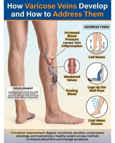 Navveda Turmeric Varicose Vein Patches | Natural Herbal Therapy for Swelling, Fatigue & Vein Health