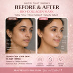 Bio-Collagen Hydration Face Mask [PACK OF 4]