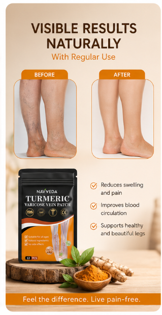 Navveda Turmeric Varicose Vein Patches | Natural Herbal Therapy for Swelling, Fatigue & Vein Health
