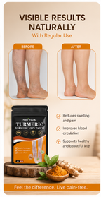 Navveda Turmeric Varicose Vein Patches | Natural Herbal Therapy for Swelling, Fatigue & Vein Health